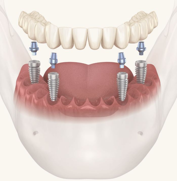 Treatments - Clear Smiles