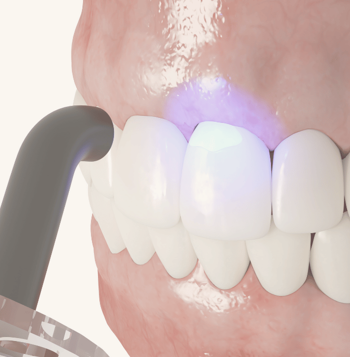 Treatments - Clear Smiles