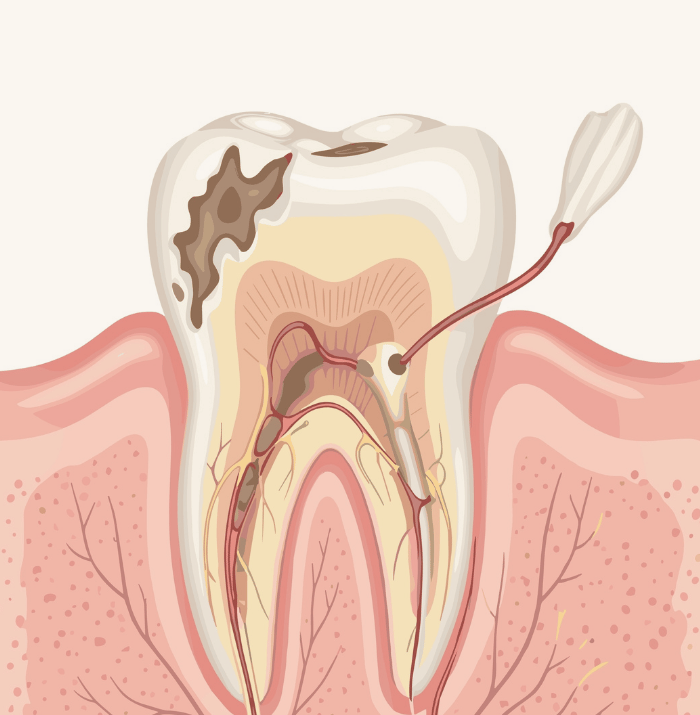 Treatments - Clear Smiles