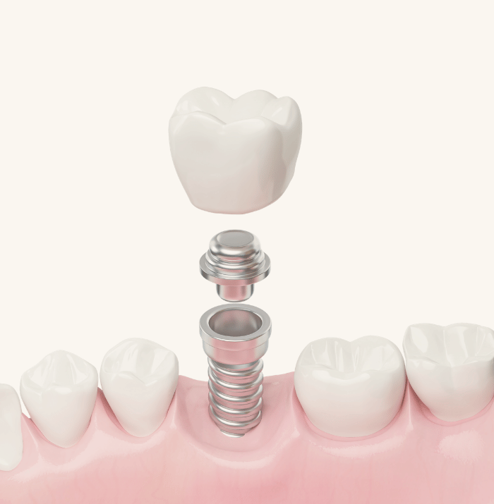 Treatments - Clear Smiles