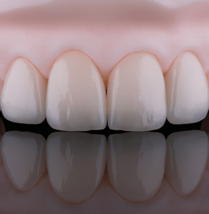 Treatments - Clear Smiles